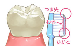 府中(府中市)の歯医者、府中後藤歯科クリニックで予防歯科